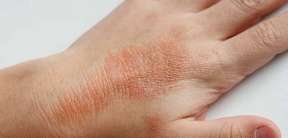 I cosmetici curano?
