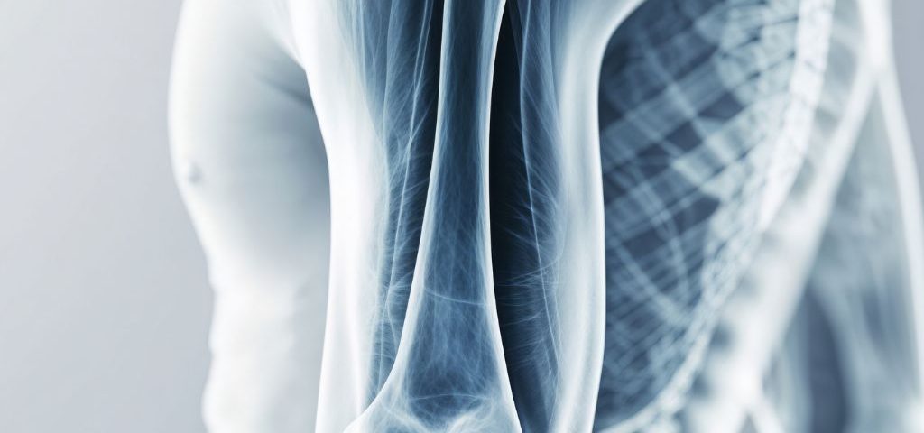 Come rafforzare le ossa in inverno