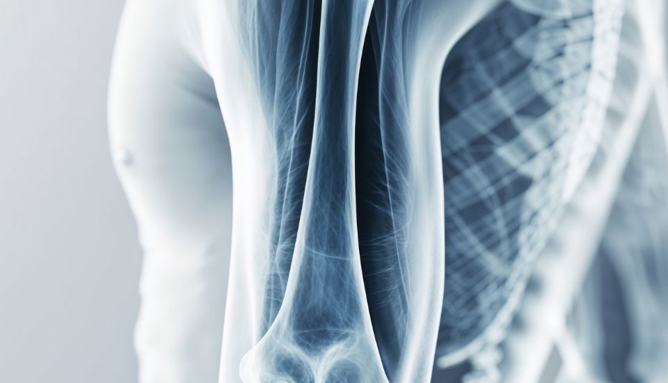 Come rafforzare le ossa in inverno